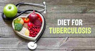 Tuberculosis Diet: What to Eat and Avoid | Dietitian in Panchkula